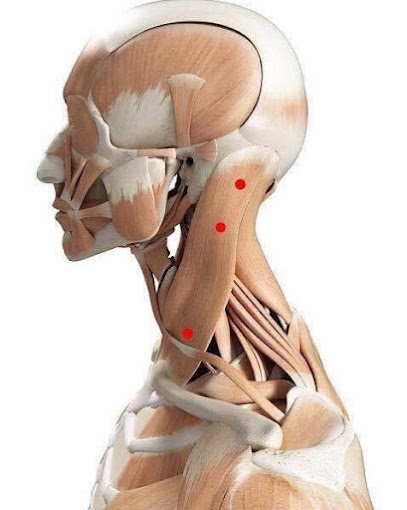 Herning osteopati